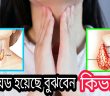 থাইরয়েড হয়েছে বুঝবেন কিভাবে ? জেনে নিন সবাই