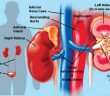 কিডনি সুস্থ রাখার ১০টি উপায় জেনে রাখুন – মায়ের হাতের রান্না