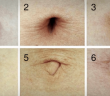 What Does The Shape Of Your Navel Say About Your Health?