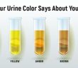 What the color of your urine and frequent urination can tell you about your health