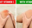 10 Signs That You Need More Of Vitamin C!