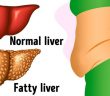 10 Warning Signs of Liver Damage You Should Not Ignore