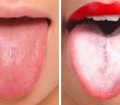 9 Things Your Tongue Is Trying to Tell You About Your Health