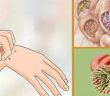 19 Signs Parasites Are Residing In Your Body,these Herbs Can Help Destroy Them