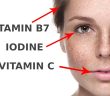 5 Signs On Your Face Indicating A Lack Of Vitamins And Minerals!