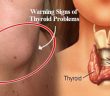 10 Warning Signs You Have Thyroid Problems!