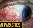 9 Signs You Could Have a Parasite!