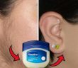 A Simple Vaseline Trick To Remove Unwanted Hair On The Body!