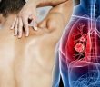 7 Signs of Lung Cancer You Might Be Ignoring!