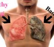 7 Eаrlу Sуmрtоmѕ of Lung Cаnсеr Yоu Shоuldn’t Ignоrе!