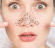 SAY GOODBYE BLACKHEADS IN 15 MINUTES!