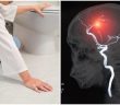 8 Warning Signs That a Stroke Is Coming On–Look for Little Things, Like Sudden Loss of Balance!